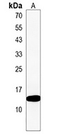 KRTCAP2 Rabbit Polyclonal Antibody
