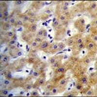 KRTCAP2 Rabbit Polyclonal Antibody
