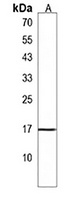 CST9 Rabbit Polyclonal Antibody