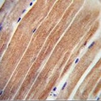 CST9 Rabbit Polyclonal Antibody