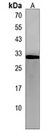 RILPL2 Rabbit Polyclonal Antibody