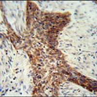 RILPL2 Rabbit Polyclonal Antibody
