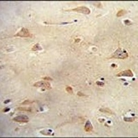 LRRC40 Rabbit Polyclonal Antibody
