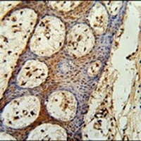 ZC3H3 Rabbit Polyclonal Antibody