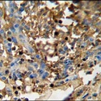 FAM20C Rabbit Polyclonal Antibody