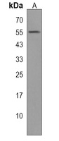 WIPF2 Rabbit Polyclonal Antibody