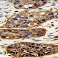 KIAA1324L Rabbit Polyclonal Antibody