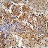 ERCC8 Rabbit Polyclonal Antibody