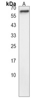 NKPD1 Rabbit Polyclonal Antibody
