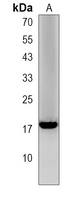 LCE1A Rabbit Polyclonal Antibody