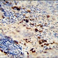 LCE1A Rabbit Polyclonal Antibody
