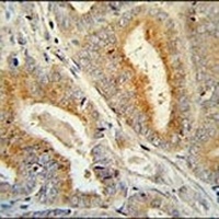 BCORL1 Rabbit Polyclonal Antibody