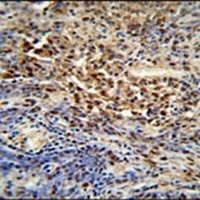 PUS3 Rabbit Polyclonal Antibody