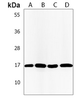 CD20L1 Antibody
