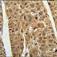RTN4IP1 Rabbit Polyclonal Antibody