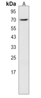 CLPX Rabbit Polyclonal Antibody
