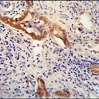 CLPX Rabbit Polyclonal Antibody