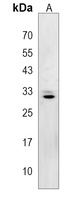 ZC4H2 Rabbit Polyclonal Antibody