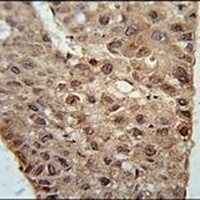 ZC4H2 Rabbit Polyclonal Antibody