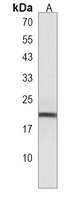 CPLX3 Rabbit Polyclonal Antibody