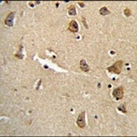 CPLX3 Rabbit Polyclonal Antibody