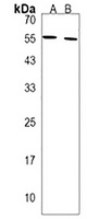 SPATC1 Rabbit Polyclonal Antibody