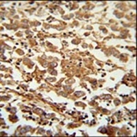 SPATC1 Rabbit Polyclonal Antibody