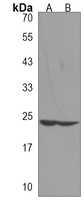 JOSD2 Rabbit Polyclonal Antibody