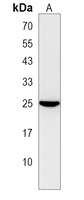 NUDT8 Rabbit Polyclonal Antibody
