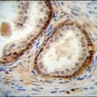 NUDT8 Rabbit Polyclonal Antibody