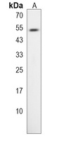 TLDC1 Rabbit Polyclonal Antibody