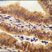 TLDC1 Rabbit Polyclonal Antibody