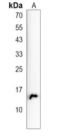 ENSA Rabbit Polyclonal Antibody