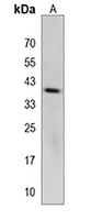 LHFPL5 Rabbit Polyclonal Antibody