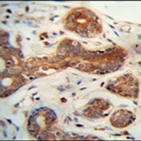 CEPT1 Rabbit Polyclonal Antibody
