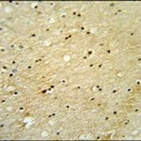 VWA3B Rabbit Polyclonal Antibody