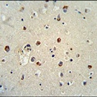 RILPL1 Rabbit Polyclonal Antibody