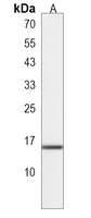 NAT14 Rabbit Polyclonal Antibody