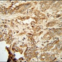 NAT14 Rabbit Polyclonal Antibody