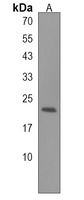 NOS1AP Rabbit Polyclonal Antibody