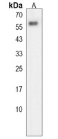GALNT4 Rabbit Polyclonal Antibody