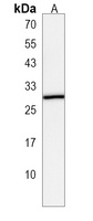 BLOC1S5 Rabbit Polyclonal Antibody