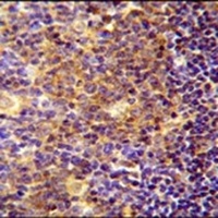 BLOC1S5 Rabbit Polyclonal Antibody