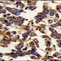 BSCL2 Rabbit Polyclonal Antibody