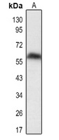 DUSP8 Antibody