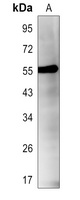 RIPK3 (Phospho-S227) Rabbit Polyclonal Antibody