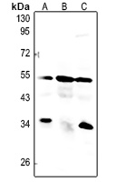 Caspase 8 Rabbit Polyclonal Antibody