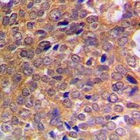 ABL1/2 (Phospho-Y393/439) Antibody