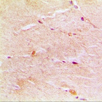 Gamma-actin-1 Rabbit Polyclonal Antibody