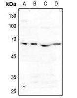 ACVR1B Rabbit Polyclonal Antibody